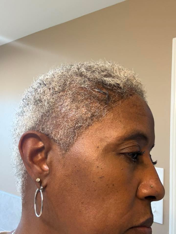 Denise before using the OrréNaturals Hair Revival Ampoule