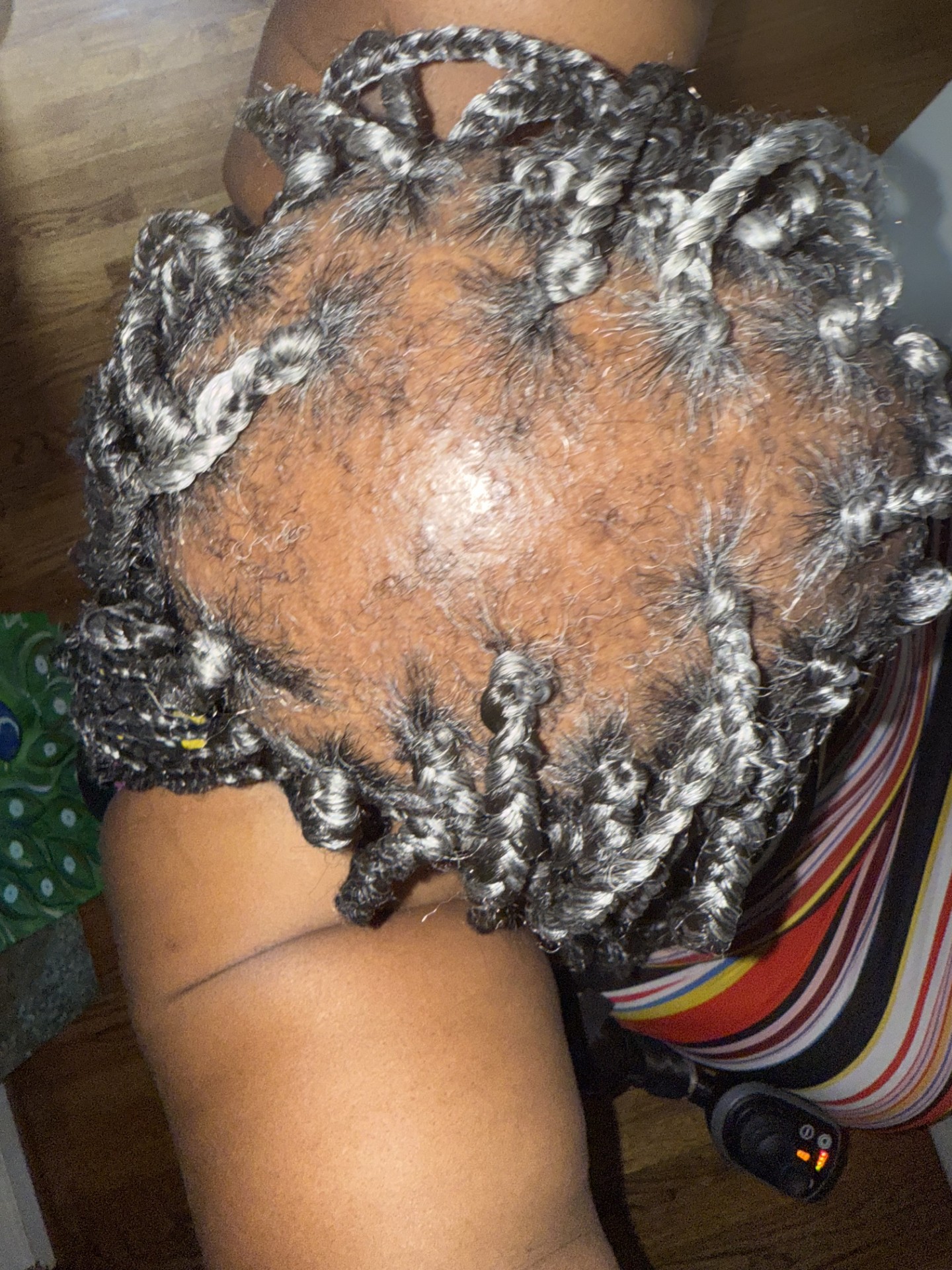 Patrice before using the OrréNaturals Hair Revival Ampoule