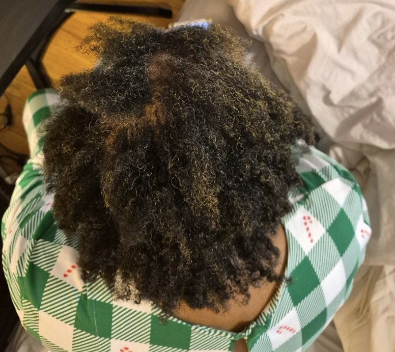Shalane after using the OrréNaturals Hair Revival Ampoule