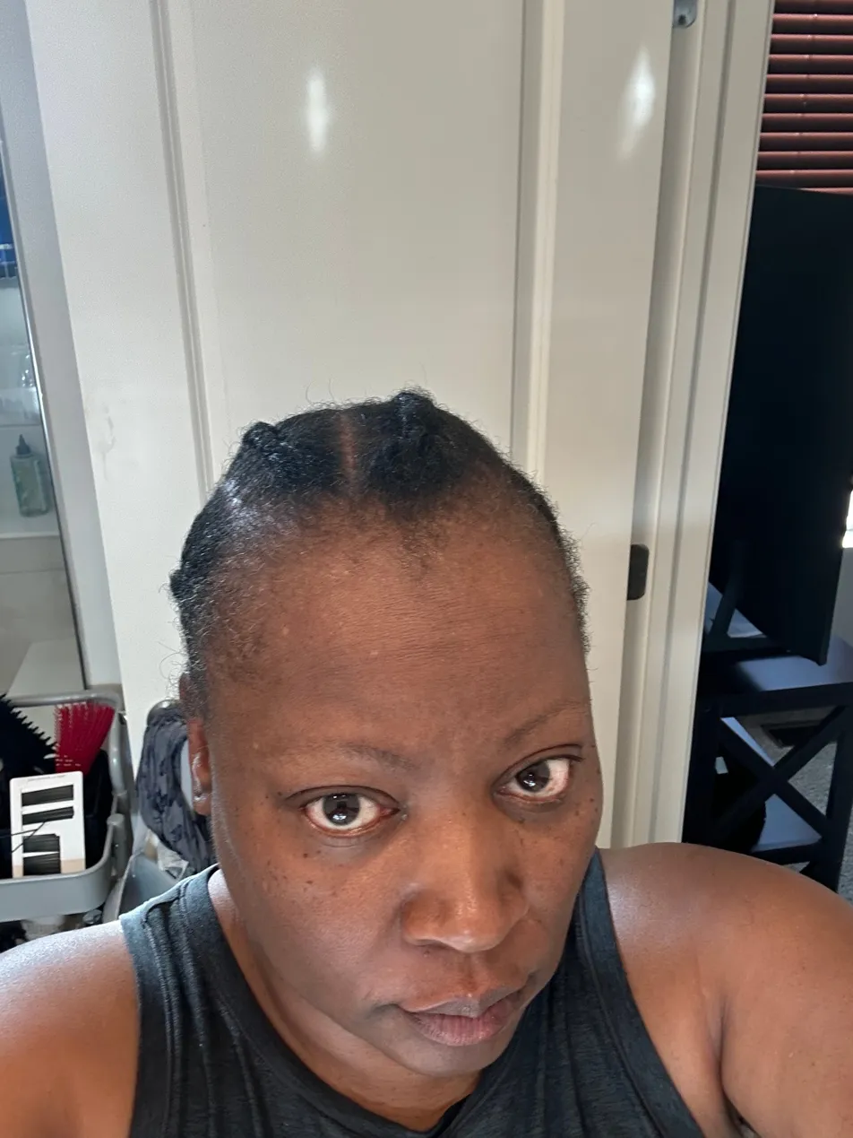 Letrise before using the OrréNaturals Hair Revival Ampoule