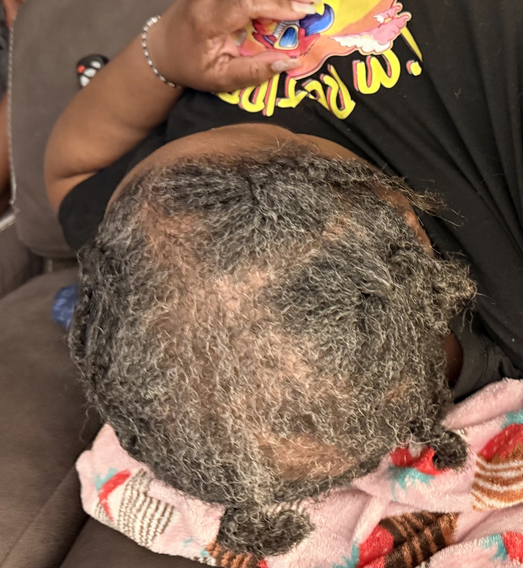 Patrice after using the OrréNaturals Hair Revival Ampoule